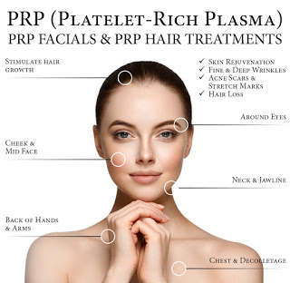 PRP Trigenics Anti Aging platelet rich plasma treatment